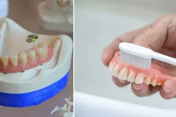 How to Get Denture Glue Out of Your Mouth