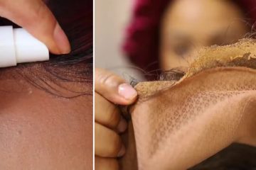 How to Remove Wig Glue From Hairline