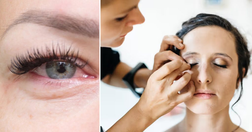 How to Treat Eyelash Glue Allergy