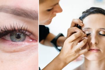 How to Treat Eyelash Glue Allergy