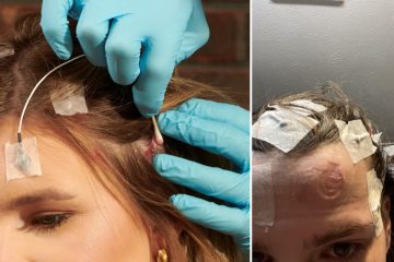 How to Remove EEG Glue From Hair