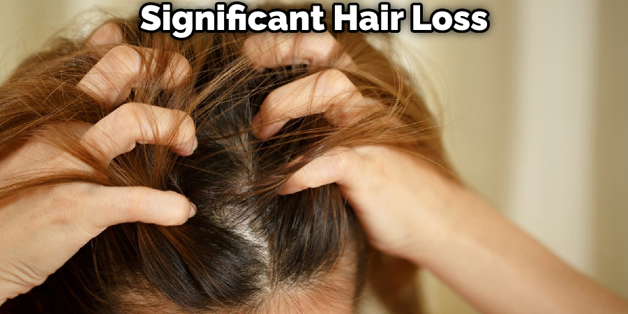 Significant Hair Loss