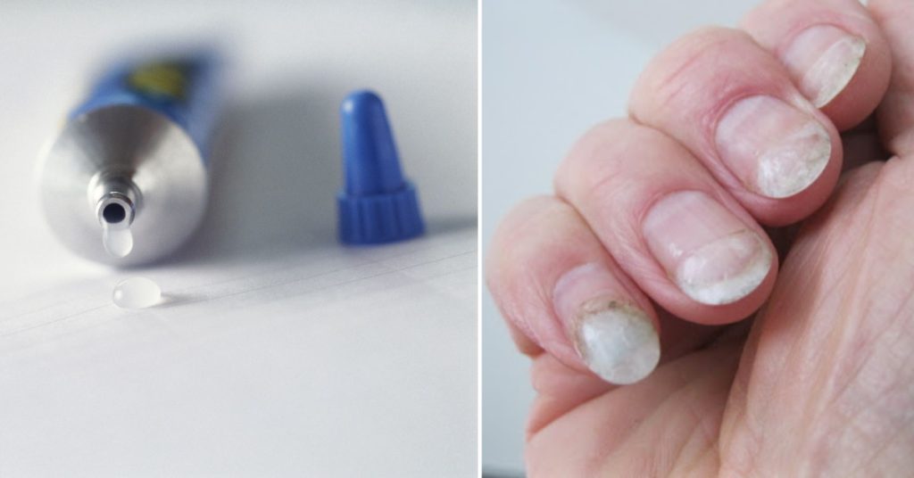 What's the Difference Between Nail Glue and Superglue