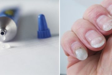 What's the Difference Between Nail Glue and Superglue